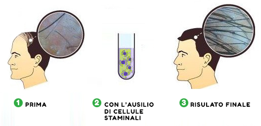 cellule staminali capelli